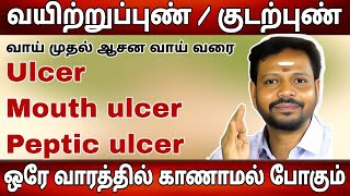 வாய் முதல் ஆசன வாய் வரை அனைத்து புண்களும் 7 லே நாட்களில் குணமாகும் mayansenthil sadhguru [upl. by Whitcher893]