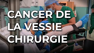 Cancer de la vessie  des techniques opératoires pour limiter la récidive et améliorer le traitement [upl. by Otrebogad830]