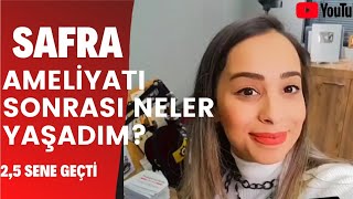 SAFRA AMELİYATINDAN SONRA NELER DEĞİŞTİKİLO ALDIM MI Sıkça sorulan soruları cevapladım [upl. by Eceinal]