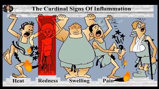 Cardinal signs of inflammation Prostaglandins and Leukotrienes [upl. by Aztiraj191]