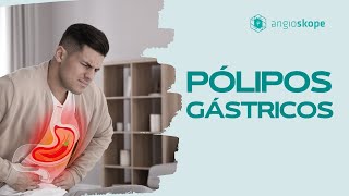 Pólipos gástricos  Clínica Angioskope [upl. by Akimihs]