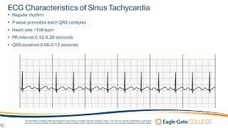 Sinus Tachycardia [upl. by Ecallaw635]