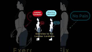 Exercise to fix Lumbar Lordosis Correct Lumbar Lordosis Posture [upl. by Daye650]