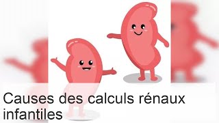 Causes des sels rénaux chez lenfant  échographie et régime alimentaire pour taux élevés [upl. by Chew]