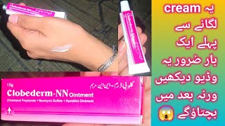 Clobederm NN Ointment Uses  Benefits Side effectsHonest Review  How To Use Clobederm NN Ointment [upl. by Lenee]