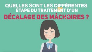 Les différentes étapes du traitement dun décalage des mâchoires [upl. by Donnamarie369]