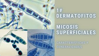 Micosis superficiales  1  Dermatofitos  Trichophyton  Epidermophyton  Microsporum [upl. by Elgna]