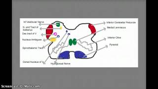 Lateral Medullary Syndrome [upl. by Spillihp572]