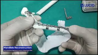 Mandibular Reconstruction using Fibula Free Flap  Step by Step Guide Mock Surgery Demo [upl. by Aneetsyrk]