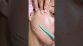 dermaplaning at home ✨ skincare skincareroutine dermaplane skincaretips skincareproducts [upl. by Refotsirc]