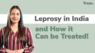 Leprosy in India and how it can be treated  World Leprosy Day [upl. by Janna]