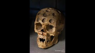 Like a Hole in the Head A History of Trepanning [upl. by Alphard149]