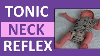 Tonic Neck Reflex in Infant Newborn  Pediatric Nursing Newborn Assessment [upl. by Huntley]