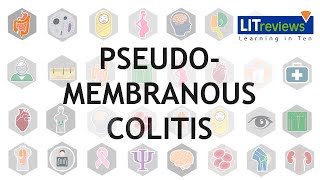 Pseudomembranous Colitis [upl. by Euh894]