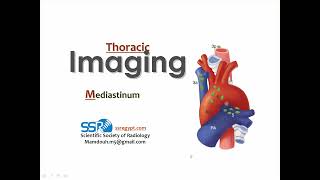 11 Imaging of the mediastinum anatomy and pathology [upl. by Lapham411]