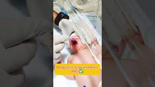 Orogastric tube insertion Nursing process hospital nursing medical trending ytshorts youtube [upl. by Asilim]