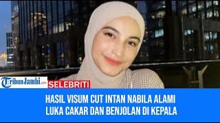 Hasil Visum Cut Intan Nabila Alami Luka Cakar dan Benjolan di Kepala [upl. by Pillsbury]