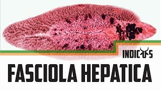 Fasciola hepatica [upl. by Arrim]