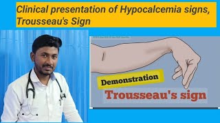 Hypocalcemia Trousseaus Sign [upl. by Glynis803]