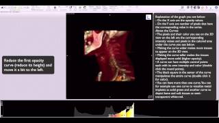 Osirix 16bit clut editor in 3D view [upl. by Tocs]