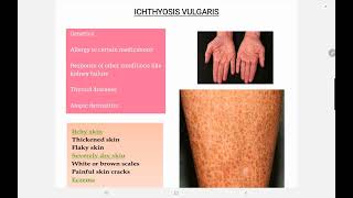 Ichthyosis Vulgaris [upl. by Holland150]