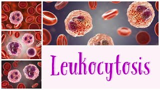 Leukocytosis hematology pathology pathologylab pathologyconcepts [upl. by Nnylirehs]