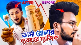 ডার্মা রোলার  ব্রণের গর্ত চুল ও দাড়ি গজাতে  ম্যাজিকের মতো কাজ করে ❤️‍🔥 [upl. by Ottavia]