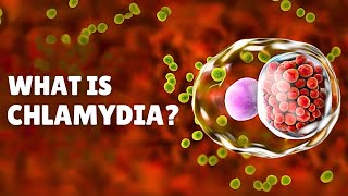 Chlamydia STI – Causes Signs and Symptoms Diagnosis amp Treatment [upl. by Magel]