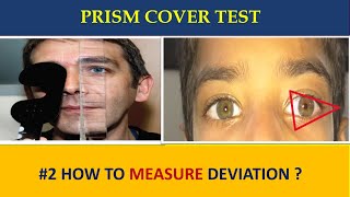 PRISM COVER TEST  everything you need to know [upl. by Ellissa617]