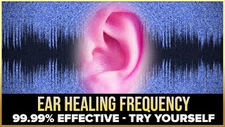 Cure All Ear Conditions  Ear Healing amp Treatment Binaural Beats Session  Healing Frequency SG31 [upl. by Lissi]