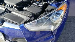 HYUNDAI CAR BATTERY REPLACEMENT [upl. by Bencion779]