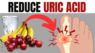 How to lower uric acid fast and naturally  Best Foods for Gout [upl. by Mirilla574]