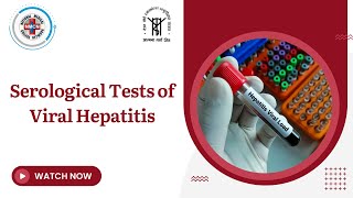 Serological Tests of Viral Hepatitis [upl. by Ajnos930]