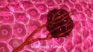 Cancer Growth Animation [upl. by Essirehc]