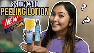 PRODUCT REVIEW EPISODE 5 NEW PACKAGING OF SKEENCARE PEELING LOTION IS OUT New vs Old  Gemyca B [upl. by Bertelli]