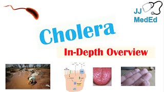 Cholera Vibrio Cholerae Pathophysiology Risk Factors Symptoms Diagnosis and Treatment [upl. by Halehs]