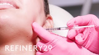 I Tried Jawline Contour amp Masseter Botox  Macro Beauty  Refinery29 [upl. by Jamilla]