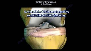 Tests For Examination Of The Knee Everything You Need To Know Dr Nabil Ebraheim [upl. by Trebron]