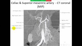 Radiological anatomy course frcr Abdomen 2  Arabic edition [upl. by Maleen]