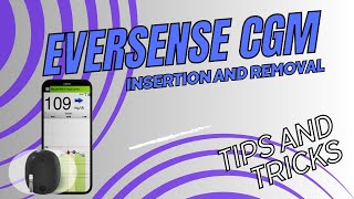 Eversense CGM Insertion and Removal Tips and Tricks [upl. by Havener997]