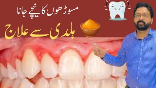 How to use TURMERIC to Cure Gum Recession Gingivitis and Bleeding Gums [upl. by Einwahr417]