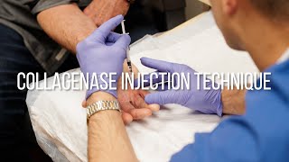 Collagenase Injection Technique for Dupuytrens Contracture [upl. by Waylen]