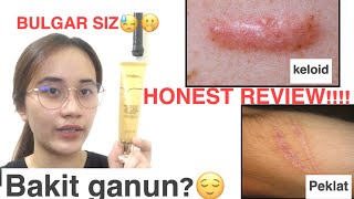 LANBENA TCM SCAR REMOVER HONEST REVIEW MABISA BA [upl. by Clabo]