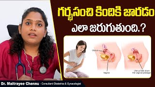 గర్భసంచి కిందకి జారడం  Uterine Prolapse Symptoms In Telugu  Causes amp Treatment  Sankhya Hospitals [upl. by Anitsahs]