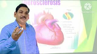 Lecture on atherosclerosis and its prevention and treatments [upl. by Sucramal972]