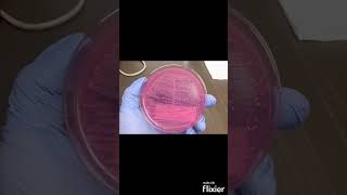 Escherichia coli E coli on MacConkey agar MAC  Clinical Microbiology shorts [upl. by Jeminah]