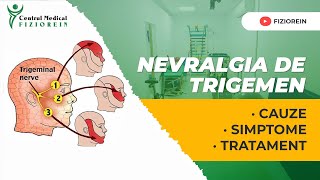 Nevralgia de trigemen Centrul Medical Fiziorein [upl. by Sulihpoeht19]