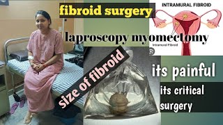 my fibroid surgery story its very painful or not intramural fibroid laproscopy myomectomy surgeryll [upl. by Olra597]