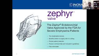 How It Works Dr Mahajan Explains the Zephyr Valve [upl. by Small]