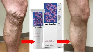 Best Medicine for Varicose Vein  Varicose Vein Treatment Medicine Veniselle [upl. by Eerak]